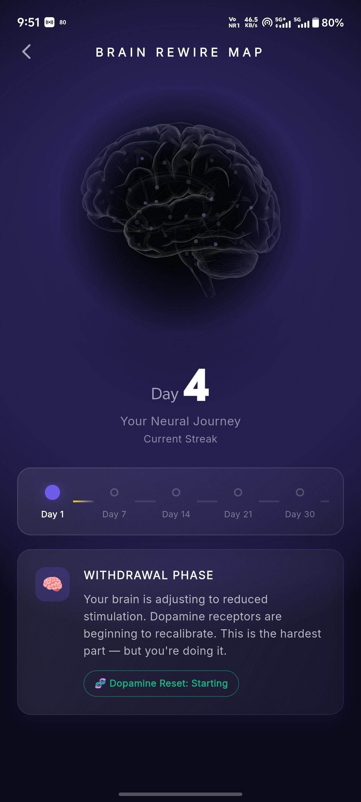 AXIOM Brain Rewire